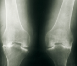 xray knee visual